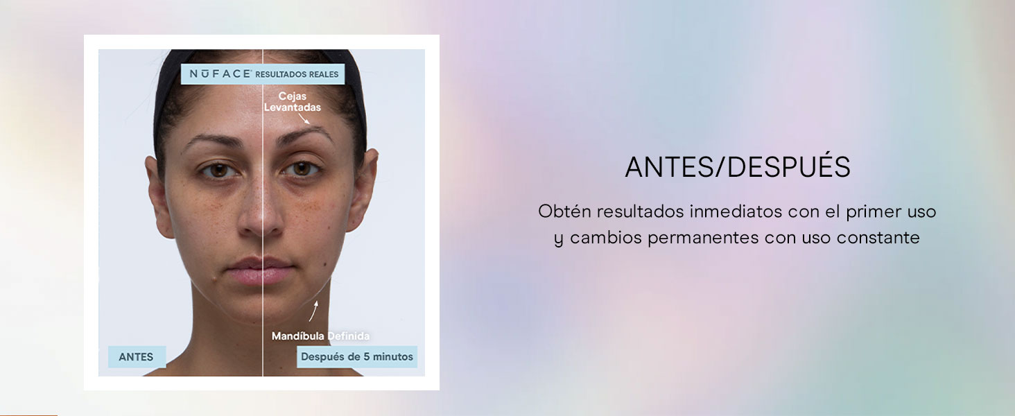 masajeador facial gel conductor facial ácido hialurónico gel gel conductor radiofrecuencia facial