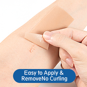 LONNIELONLI Silicone Scar Sheets, How to use 2