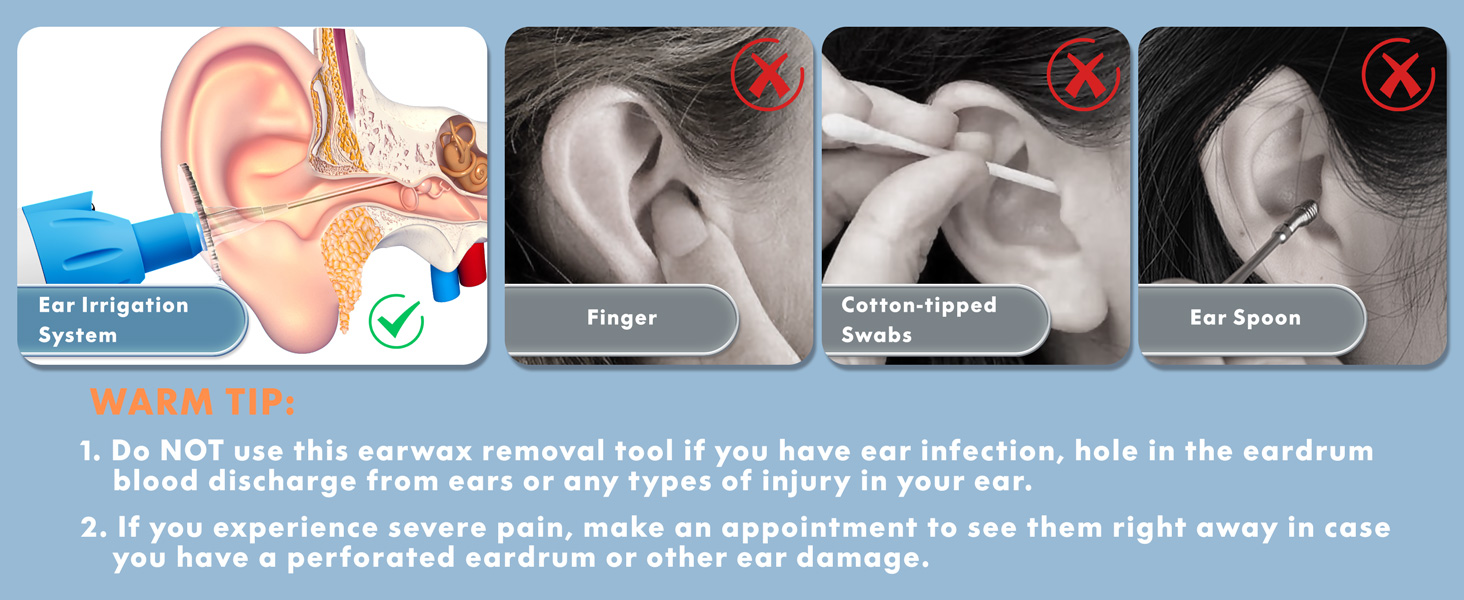 Ear irrigation system 003