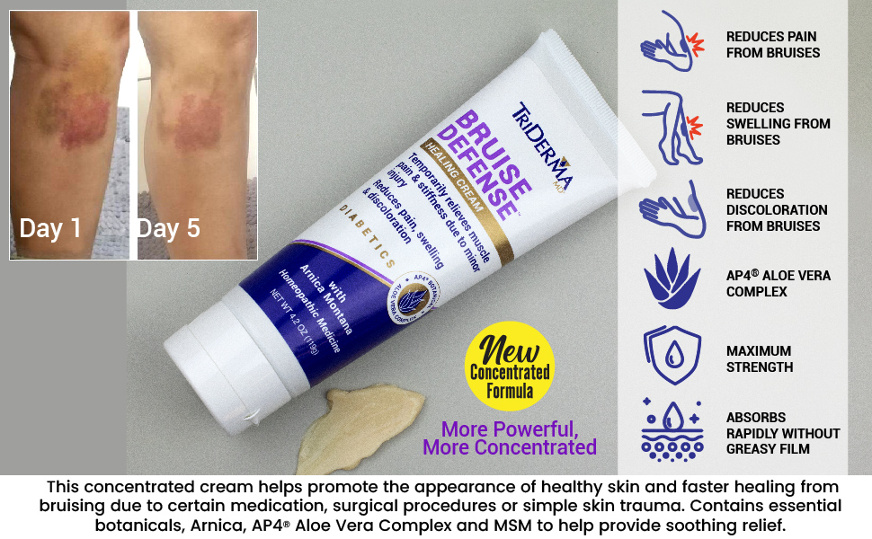 Bruise Defense Healing Cream