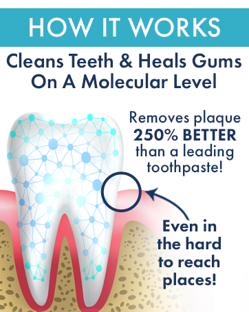 livfresh dental gel cleans teeth and removes plaque