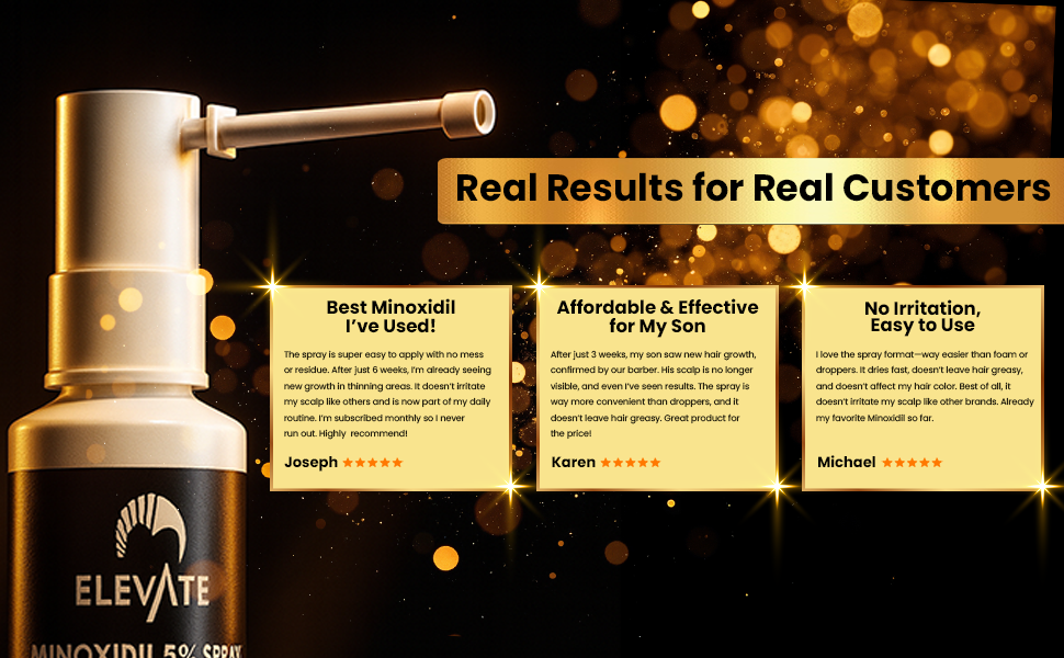 keeps minoxidil for men