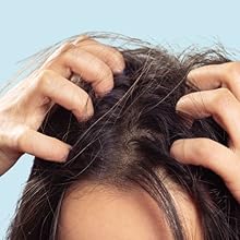 Dry Scalp