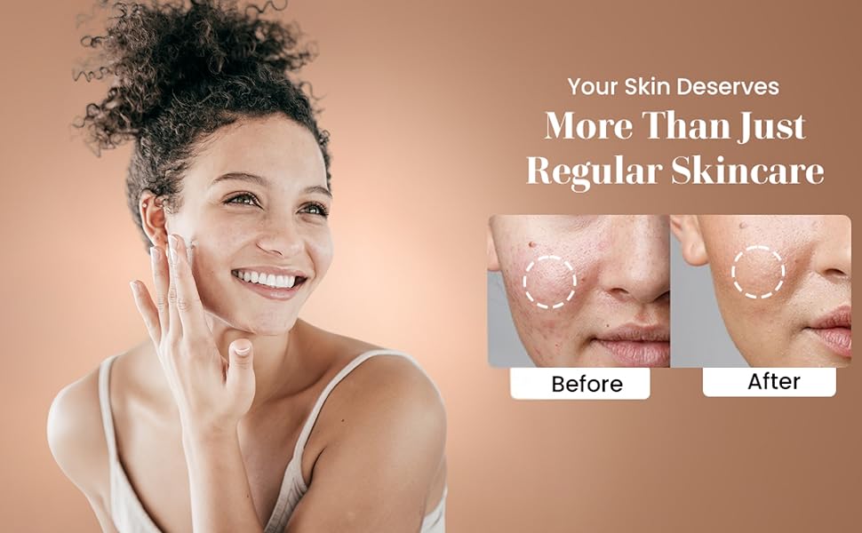 Organic moisturizer results  Nourishing cream for smooth skin  Anti-inflammatory