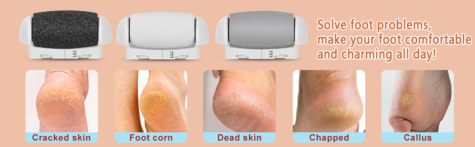 callus remover for feet