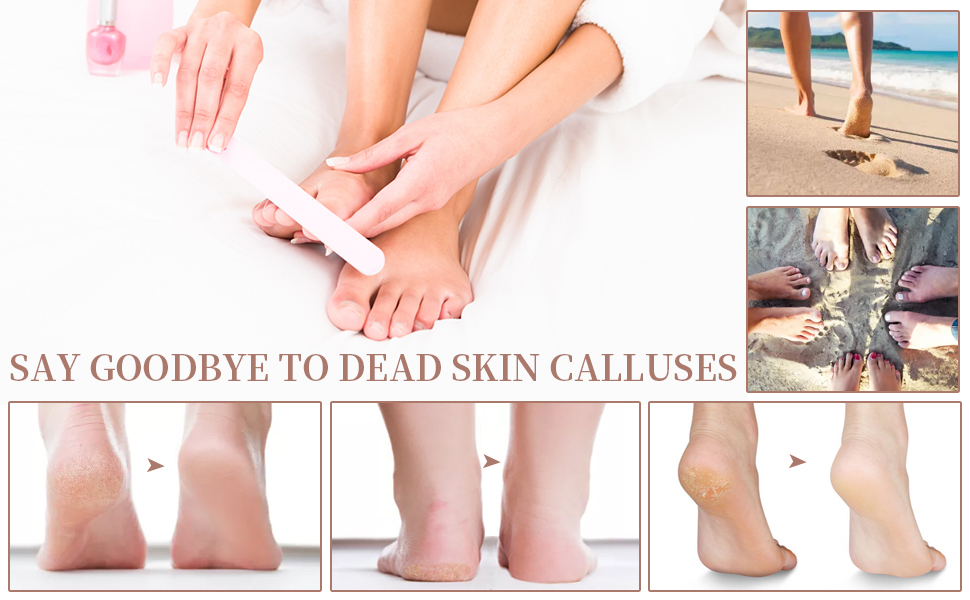Easily remove dead skin