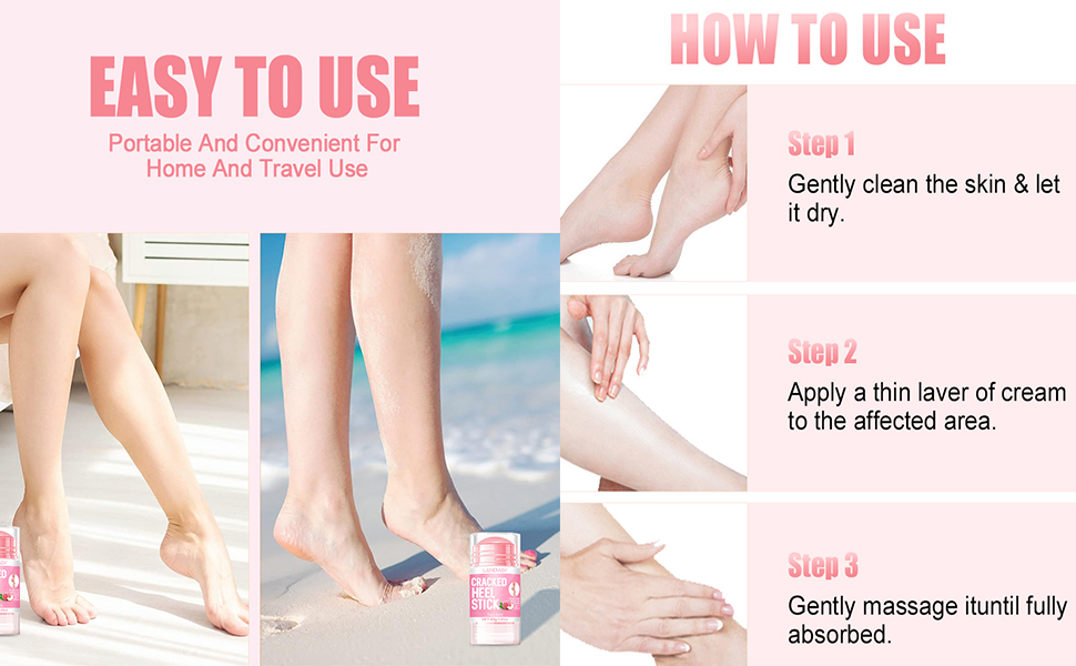 salicylic acid cream