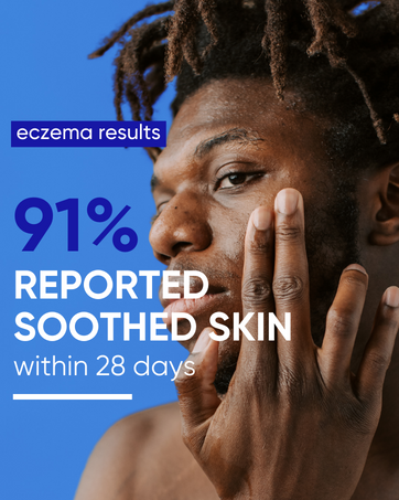 anti itch cream extra strength eczema cream eczema for adults eczema healing cream