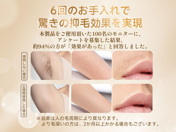 KEDON脱毛器 9段階設定 最大出力225J/cm² 試してみた】家庭用脱毛器ケノンの最新モデルを正直レビュー