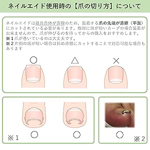 Amazon | ネイルエイド 18㎜ 巻き爪 矯正 自分で 巻きづめ