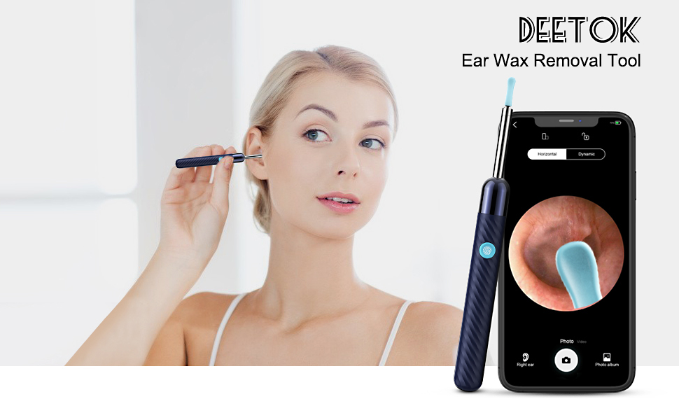 Ear Wax Removal, Ear Cleaner with Camera, Ear Wax Removal