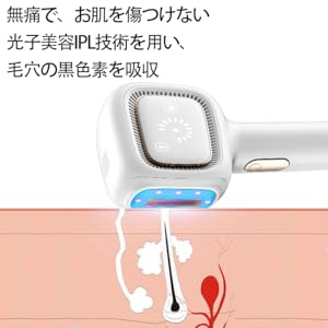 AISLE 脱毛器 2022最新ドイツ 光学技術 サファイア 冷感脱毛器 軽量 Amazon | AISLE 脱毛器 2022最新ドイツ 光学技術 サファイア 冷