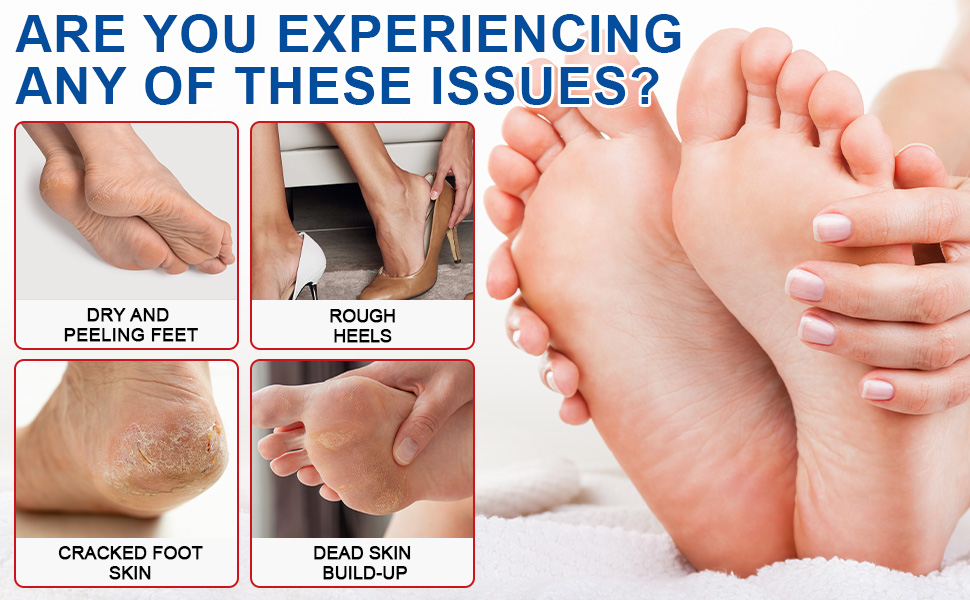 Urea Cream Stick 60% plus 2% Salicylic Acid for Feet Maximum Strength