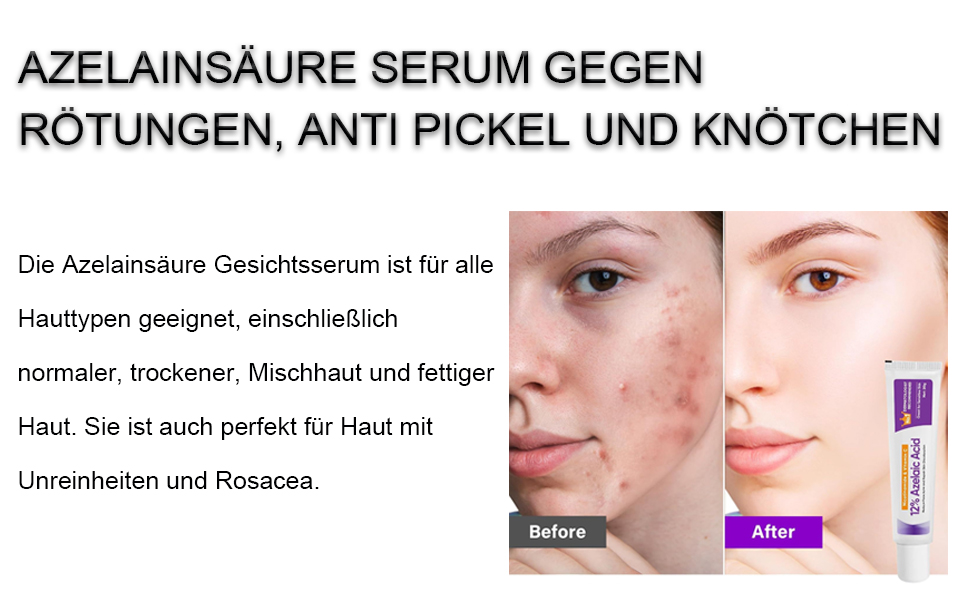 78f443ab 40e0 483e 868b 1150544b0cf3. CR0,0,970,600 PT0 SX970 V1