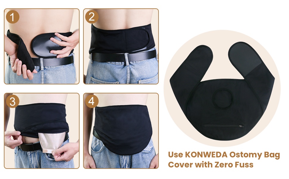 ostomy belt