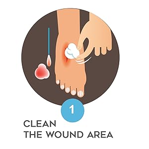 skin care gauze pads aqua cell silver dressings for wounds dressing bed sores treatment