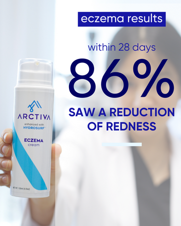facial relief cream for eczema moisture eczema cream severe eczema treatment