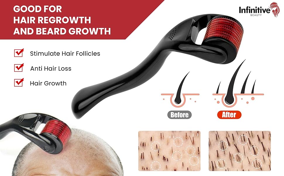 540 DERMA ROLLER