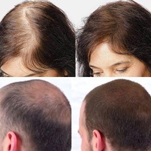 Hair Building Fibers