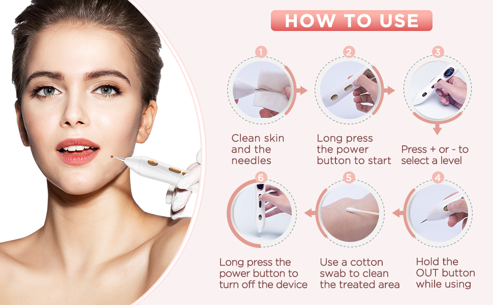 Amazon.com : Skin Tag Remover - Portable Skin Tag Removal Pen with - Skinfinity Skin Tag Remover Where To Buy