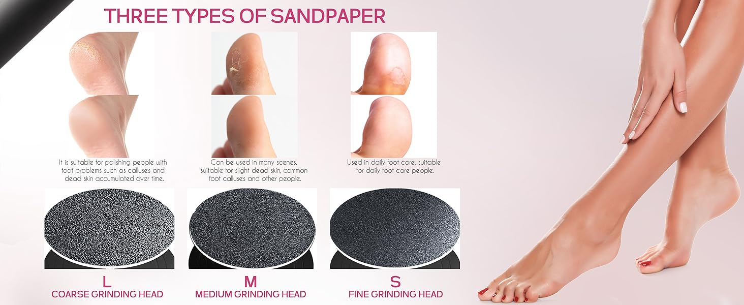 Electric Callus Remover for Feet