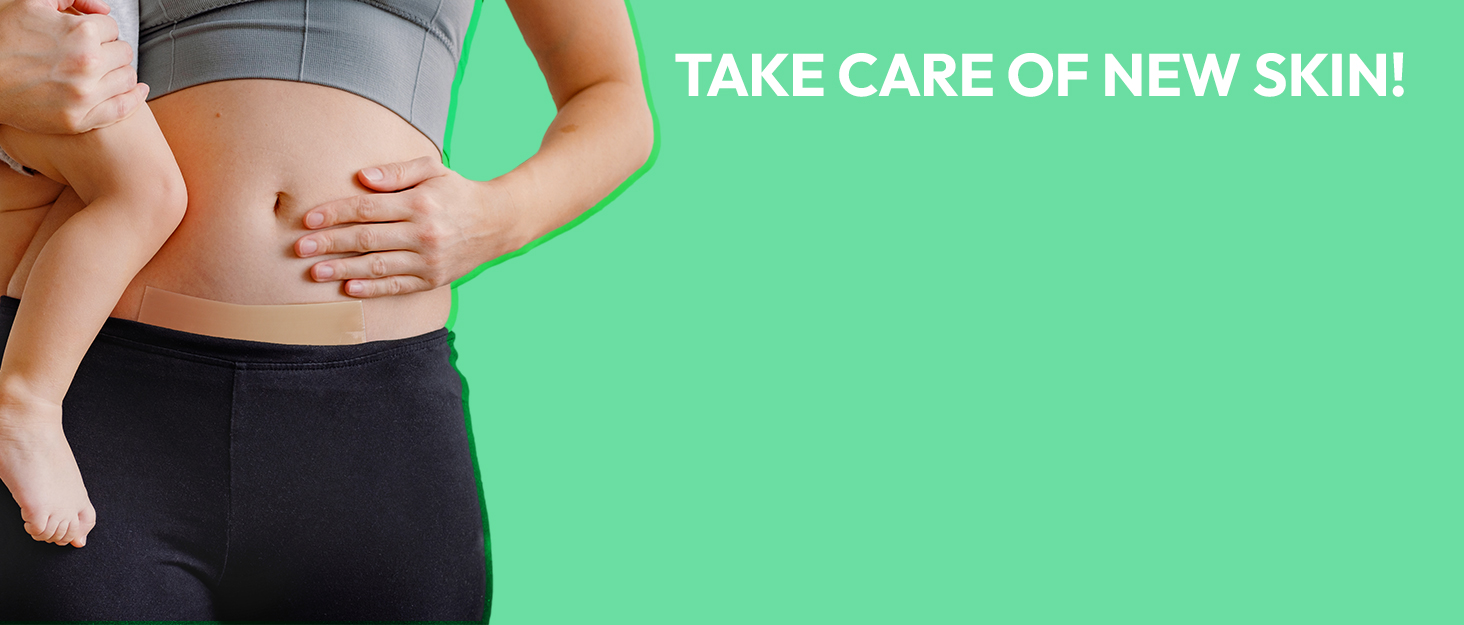 Silicone Scar Sheets