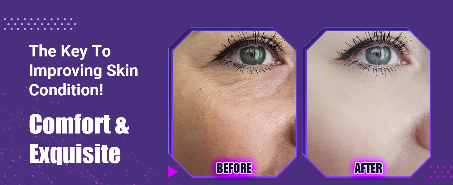 High Frequency Wand UUPAS High Frequency Facial Device