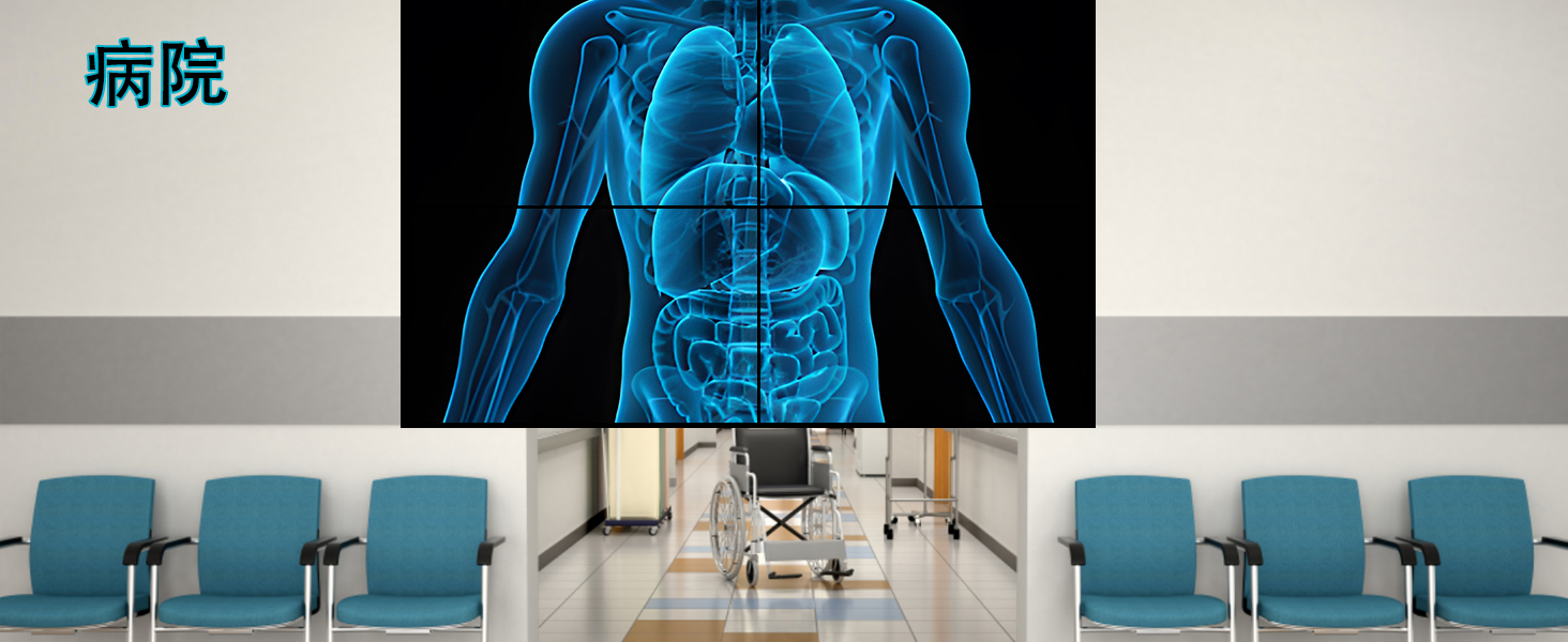 このケースは、マルチホールデザインの合金製で、干渉防止、耐腐食性、放熱性能に優れ、長寿命を実現します。