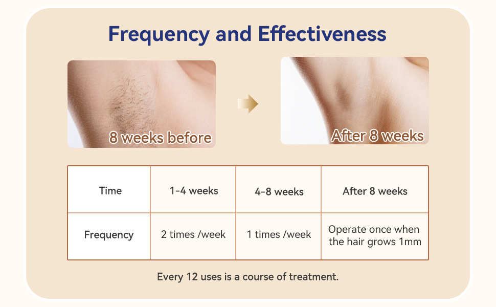 GERY IPL Hair Remover Treatment