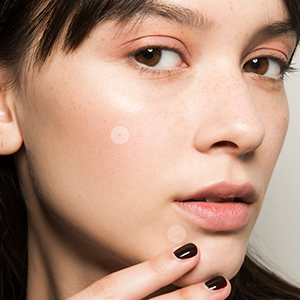 Acne patches