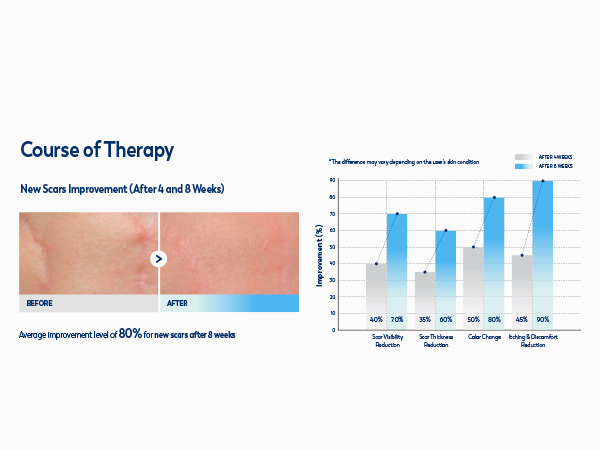 100% Silicone Scar Gel Scar Cream M3-2