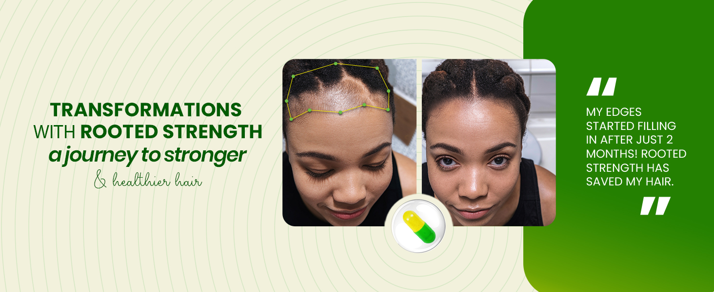 nutrafol, viviscal, biotin, collagen, dht blocker, best hair growth pills