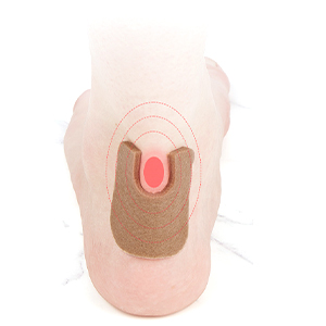 Callus Cushions U-Shaped Callus Pads and Elliptical Foam Corn Pads Set for Foot