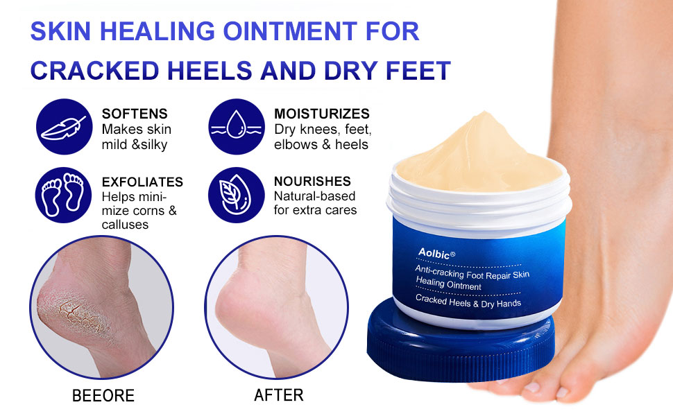 Foot Cream, Cracked Heels & Dry Hands Intense Skin