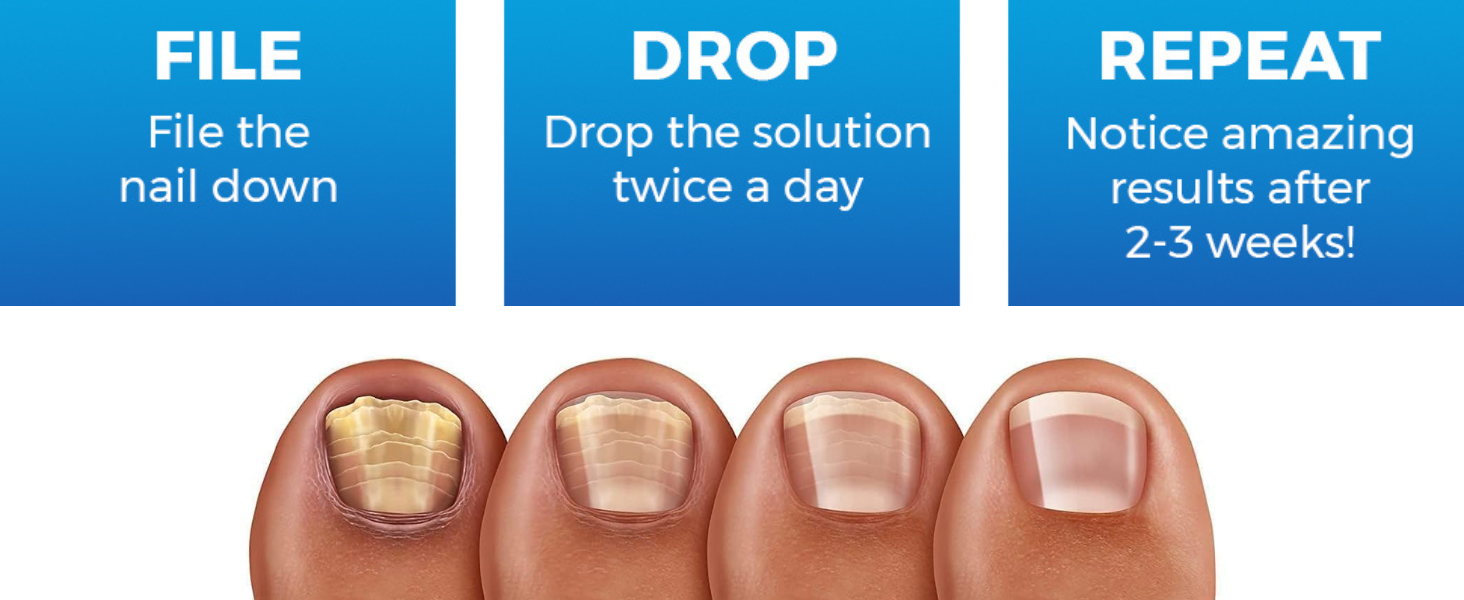 nail fugnal