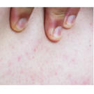 sensitive skin image