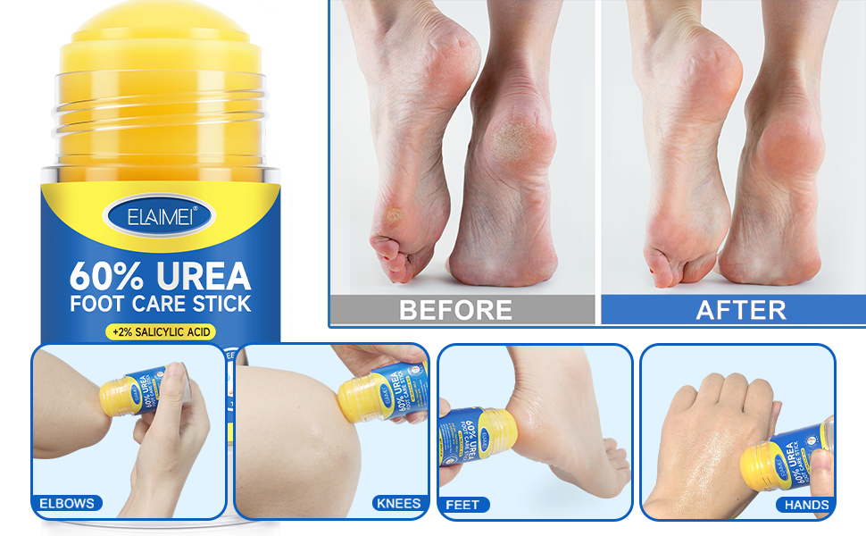 Urea Foot Cream