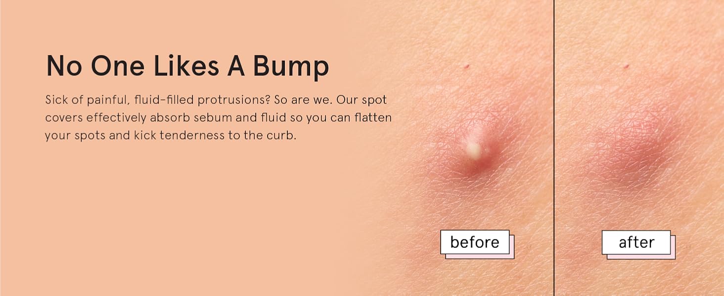 Our fun and colorful under eye patches eye gel pads are vegan, cruelty free and paraben free