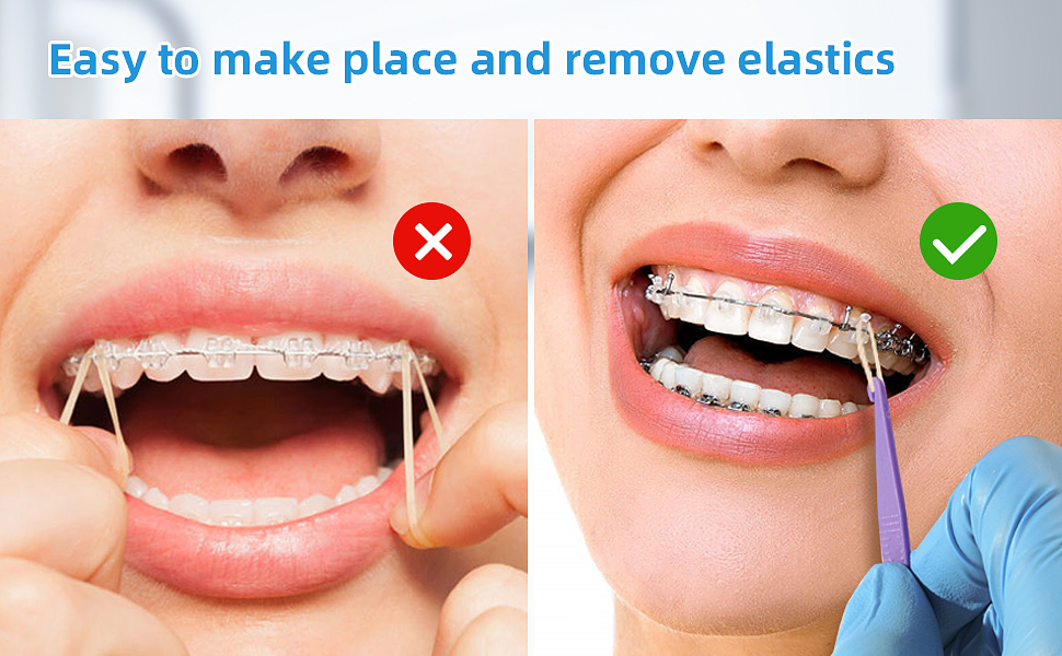 Dental Orthodontic Elastics Rubber Bands with 5 Pcs Placers, 500pcs