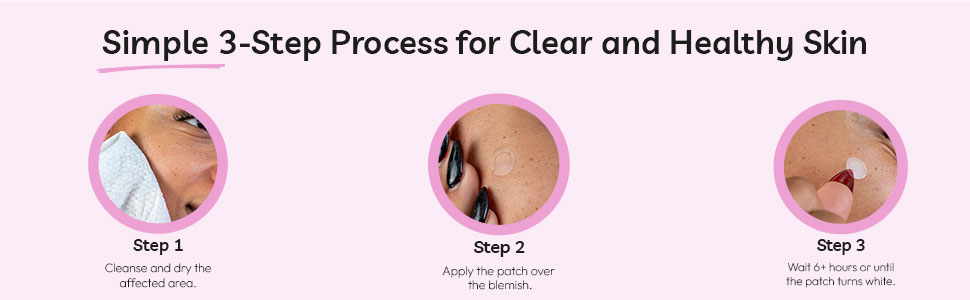 acne dots, spot dots, blemish patch, dots for spots, zit patch, blemish remover