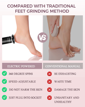 Foot Callus Remover Tool