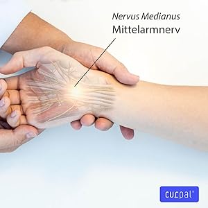 karpaltunnel syndrom carpal tunnel curpal