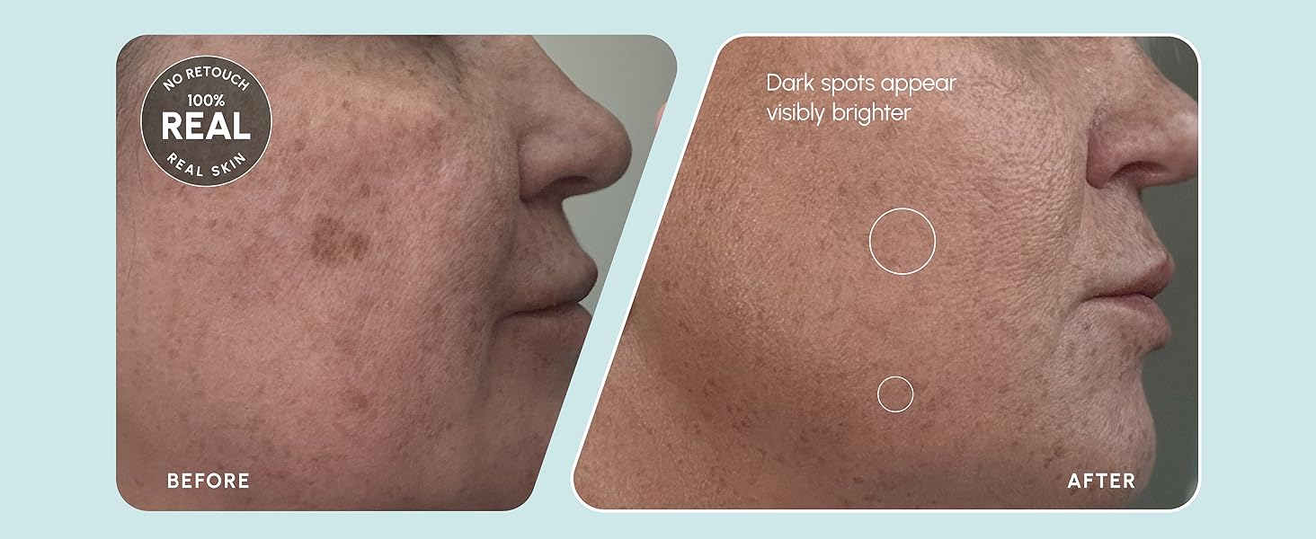 acido salicilico para la cara acido salicilico ordinary cosrx blackhead power liquid bha face toner