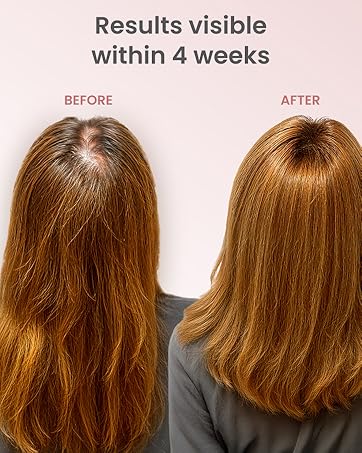 hair growth products oil spray loss treatments women regrowth treatment