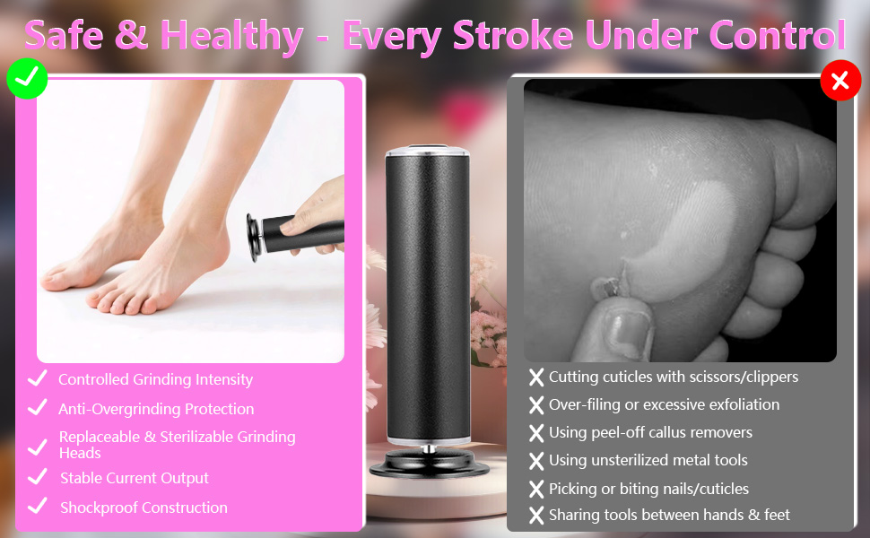 Foot Callus Remover for Foot Health