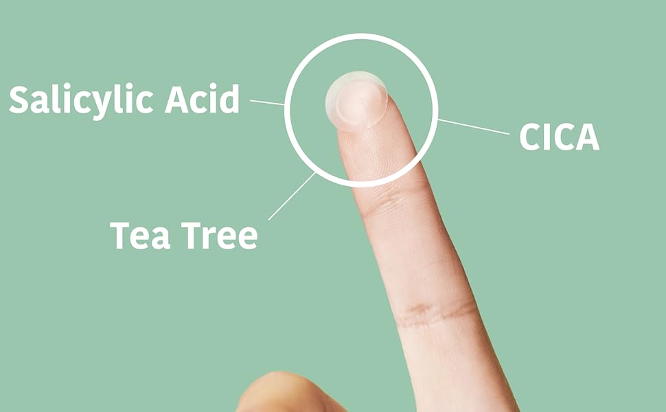 sos-pimplepatches-06