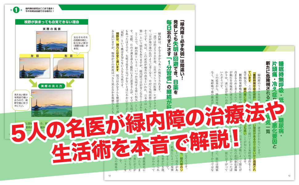 緑内障 眼科医の私が患者ならこう対処！名医が教える最新1分習慣