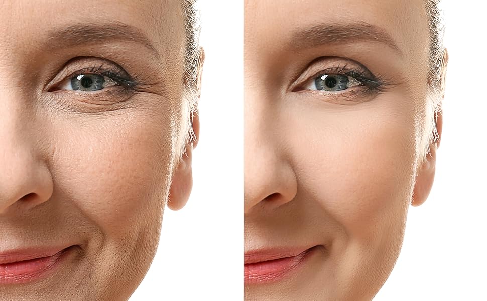 before and after of woman 