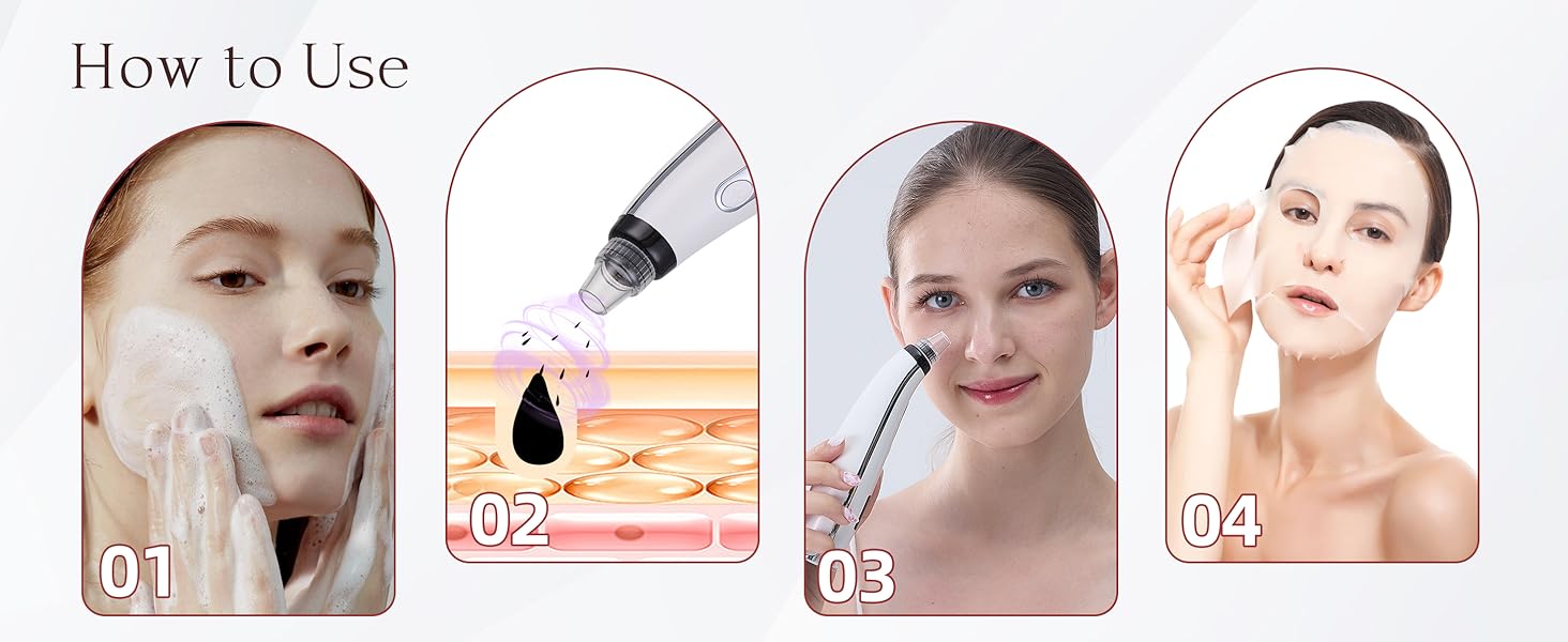 Blackhead Remover
