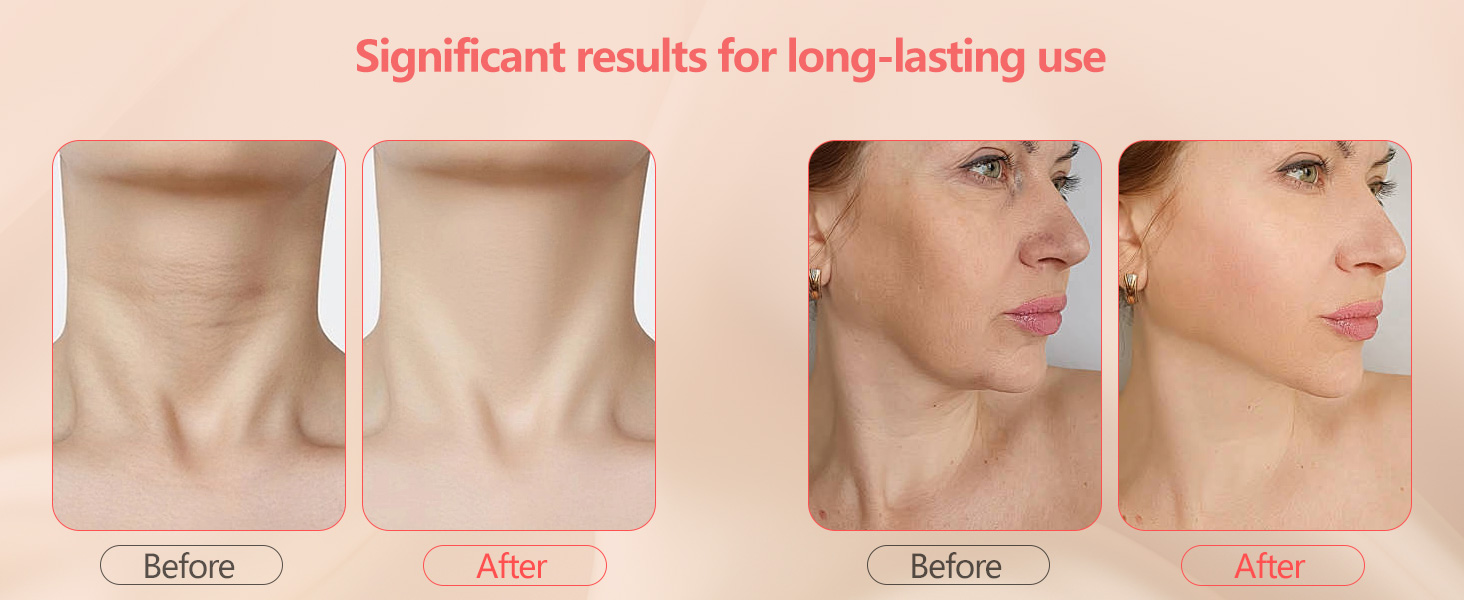 facial set for skin care for women
